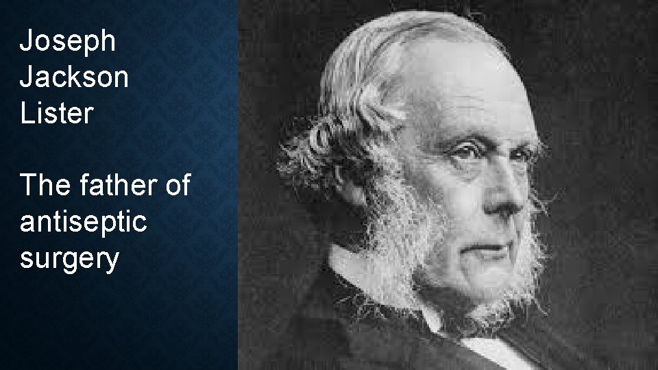 Joseph Jackson Lister The father of antiseptic surgery 