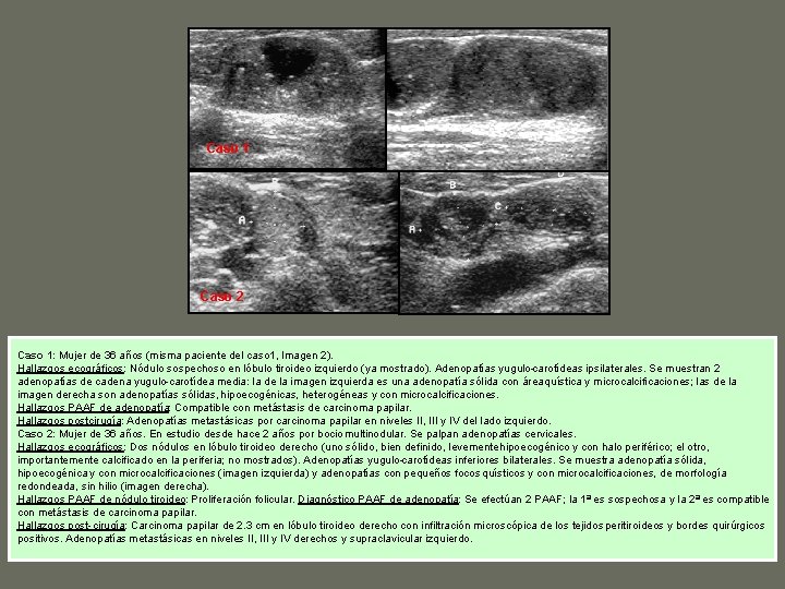 Caso 1 Caso 2 Caso 1: Mujer de 36 años (misma paciente del caso