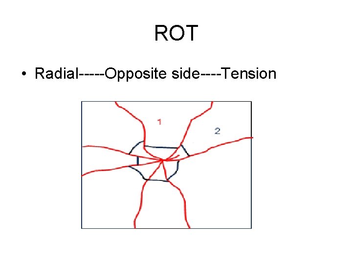 ROT • Radial-----Opposite side----Tension 