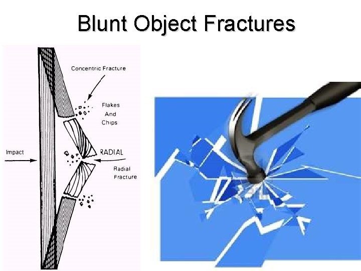 Blunt Object Fractures 