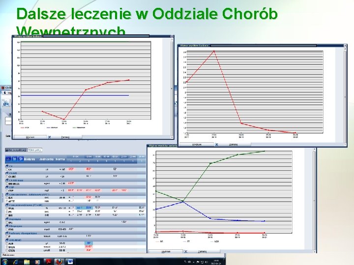 Dalsze leczenie w Oddziale Chorób Wewnetrznych 