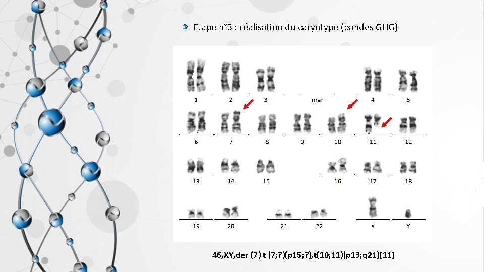 Etape n° 3 : réalisation du caryotype (bandes GHG) 46, XY, der (7) t