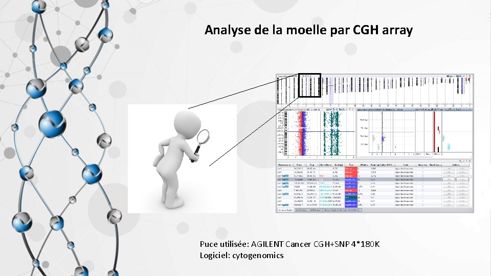 Analyse de la moelle par CGH array Puce utilisée: AGILENT Cancer CGH+SNP 4*180 K