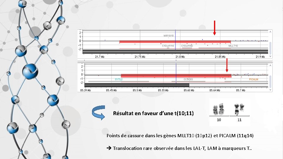 Résultat en faveur d’une t(10; 11) Points de cassure dans les gènes MLLT 10