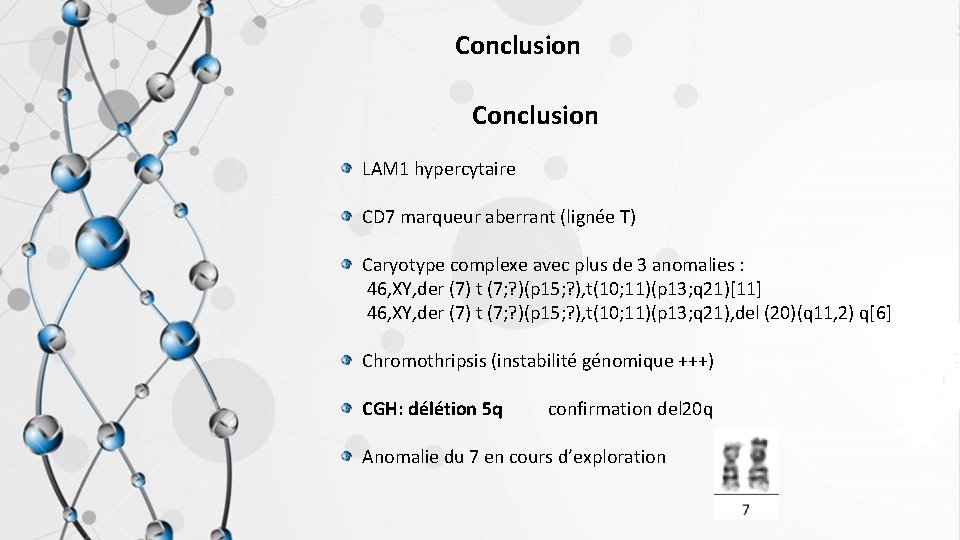 Conclusion LAM 1 hypercytaire CD 7 marqueur aberrant (lignée T) Caryotype complexe avec plus