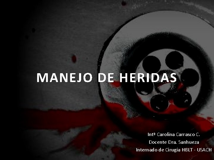 MANEJO DE HERIDAS Intª Carolina Carrasco C. Docente Dra. Sanhueza Internado de Cirugía HBLT