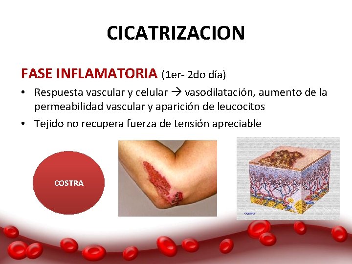 CICATRIZACION FASE INFLAMATORIA (1 er- 2 do día) • Respuesta vascular y celular vasodilatación,