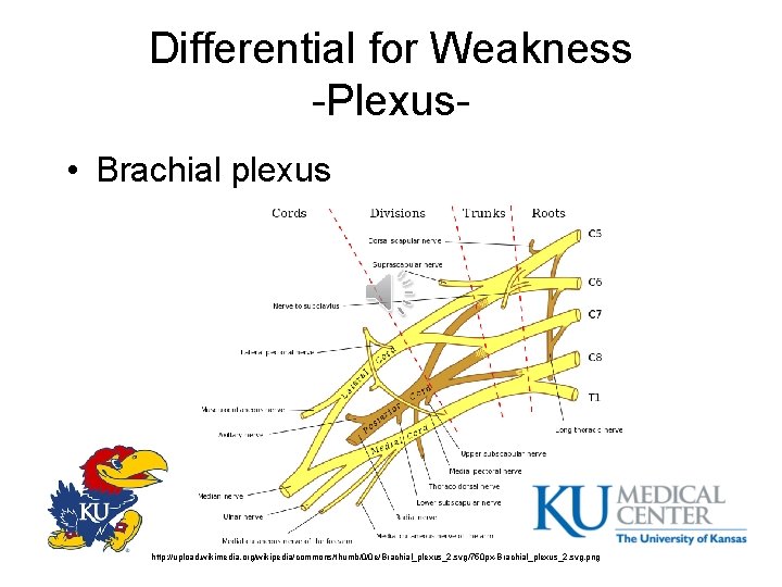 Differential for Weakness -Plexus • Brachial plexus http: //upload. wikimedia. org/wikipedia/commons/thumb/0/0 e/Brachial_plexus_2. svg/750 px-Brachial_plexus_2.