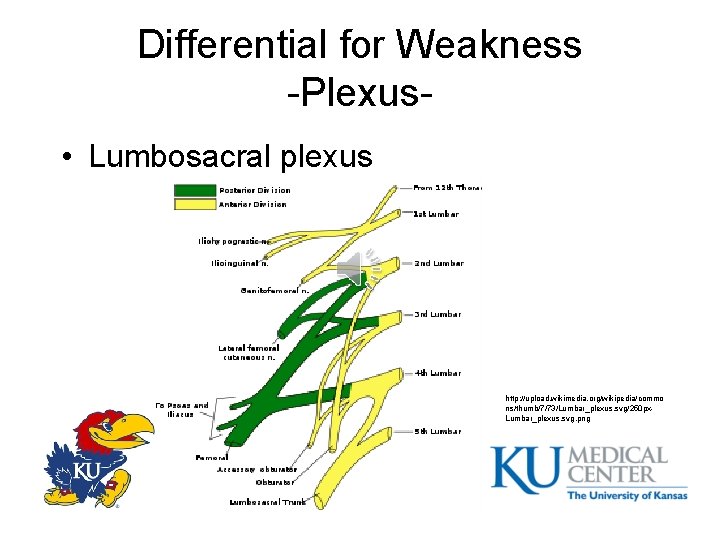 Differential for Weakness -Plexus • Lumbosacral plexus http: //upload. wikimedia. org/wikipedia/commo ns/thumb/7/73/Lumbar_plexus. svg/250 px.