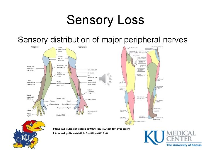 Sensory Loss Sensory distribution of major peripheral nerves http: //en. wikipedia. org/w/index. php? title=File: