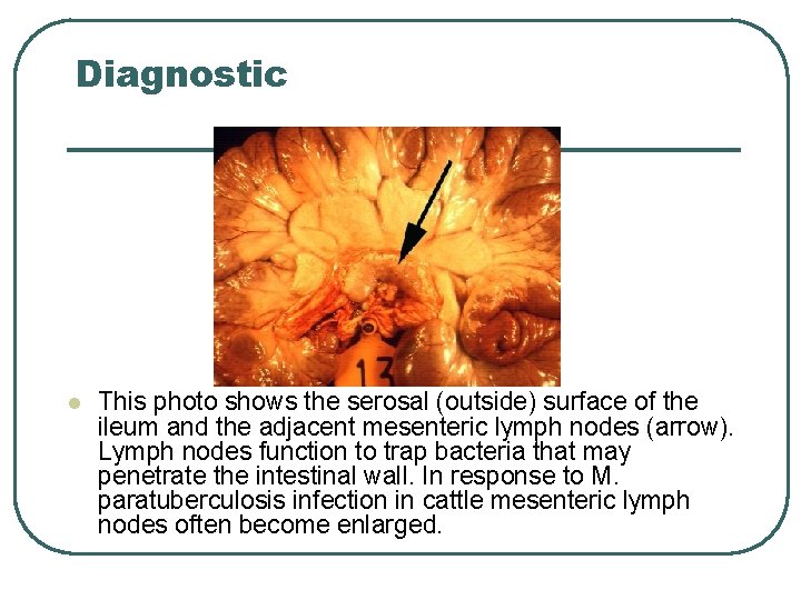 Diagnostic l This photo shows the serosal (outside) surface of the ileum and the Diagnostic l This photo shows the serosal (outside) surface of the ileum and the