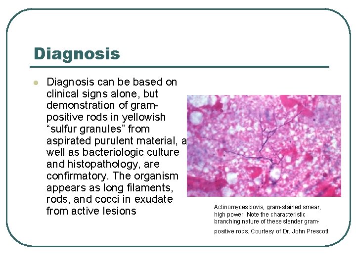 Diagnosis l Diagnosis can be based on clinical signs alone, but demonstration of grampositive Diagnosis l Diagnosis can be based on clinical signs alone, but demonstration of grampositive