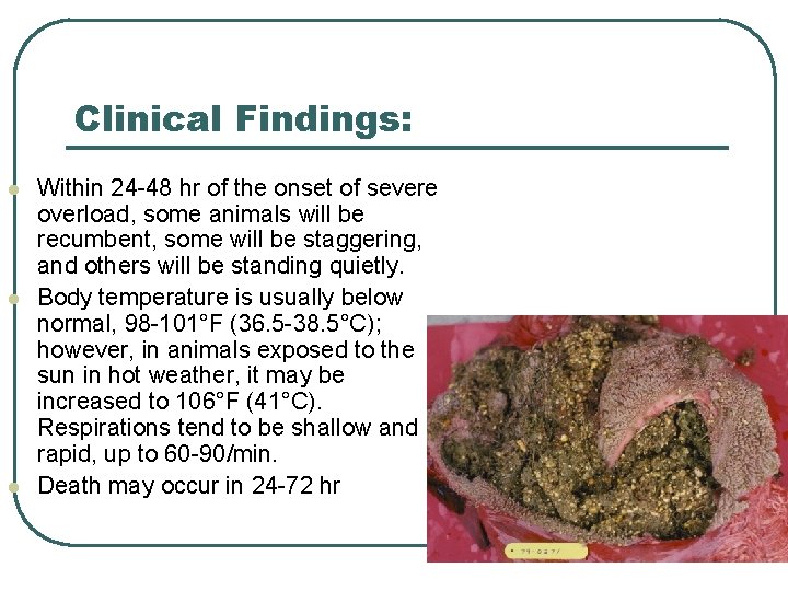 Clinical Findings: l l l Within 24 -48 hr of the onset of severe Clinical Findings: l l l Within 24 -48 hr of the onset of severe