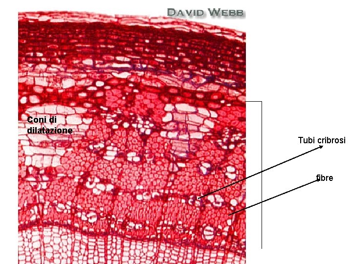 Coni di dilatazione Tubi cribrosi fibre 