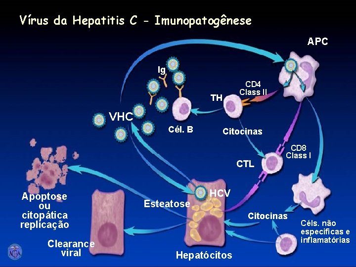 Vírus da Hepatitis C - Imunopatogênese APC Ig CD 4 Class II TH VHC