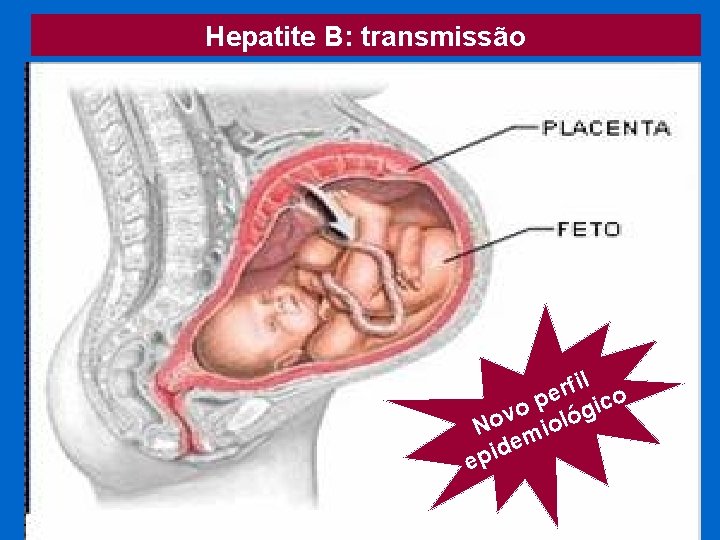 Hepatite B: transmissão Concentração elevada Concentração baixa Sangue Exsudatos Urina Fezes Suor Lágrimas Leite