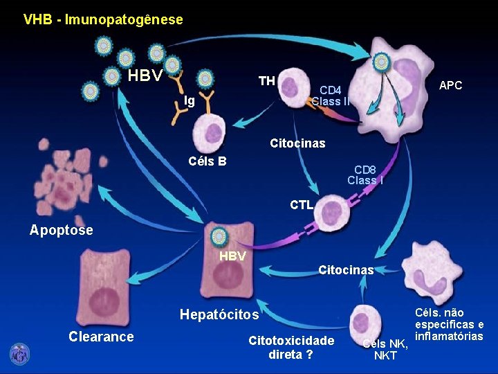 VHB - Imunopatogênese HBV TH Ig APC CD 4 Class II Citocinas Céls B