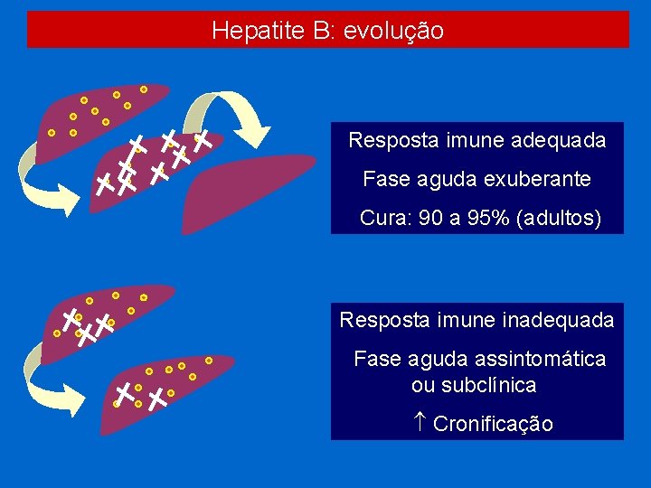 Hepatite B: evolução Resposta imune adequada Fase aguda exuberante Cura: 90 a 95% (adultos)