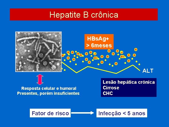 Hepatite B crônica HBs. Ag+ > 6 meses ALT Resposta celular e humoral Presentes,