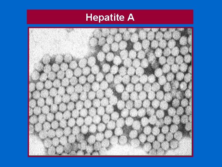 Hepatite A 