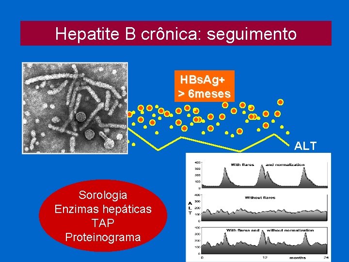 Hepatite B crônica: seguimento HBs. Ag+ > 6 meses ALT Sorologia Enzimas hepáticas TAP