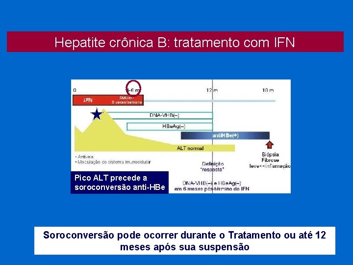Hepatite crônica B: tratamento com IFN Pico ALT precede a soroconversão anti-HBe Soroconversão pode