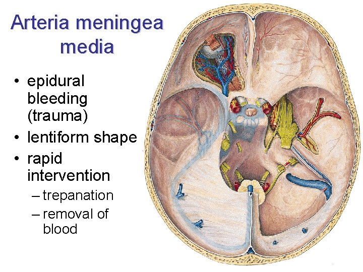 Arteria meningea media • epidural bleeding (trauma) • lentiform shape • rapid intervention –