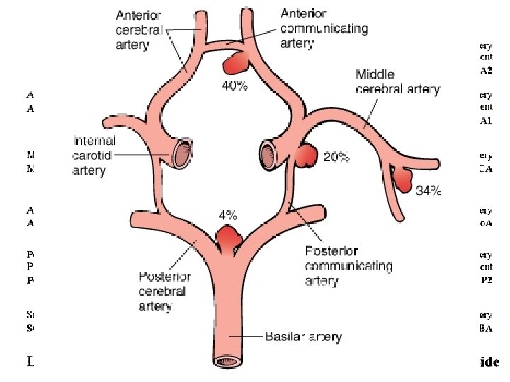 Aneurysms 