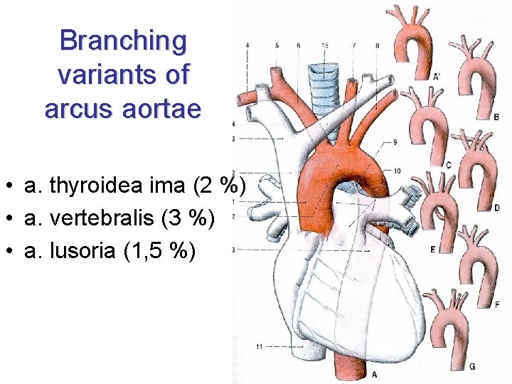 Branching variants of arcus aortae • a. thyroidea ima (2 %) • a. vertebralis