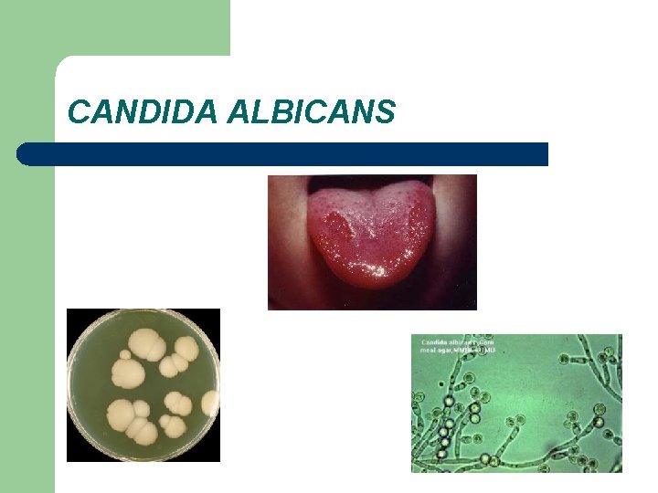 CANDIDA ALBICANS 