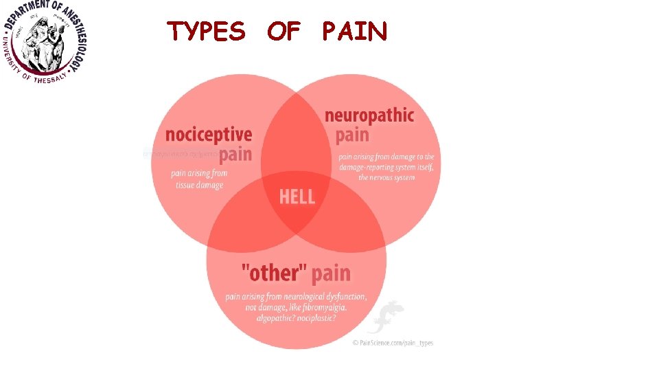 TYPES OF PAIN 