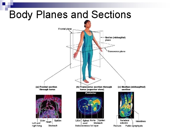 Body Planes and Sections 
