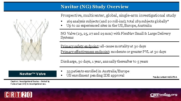 Navitor (NG) Study Overview Prospective, multicenter, global, single-arm investigational study § § 169 analysis