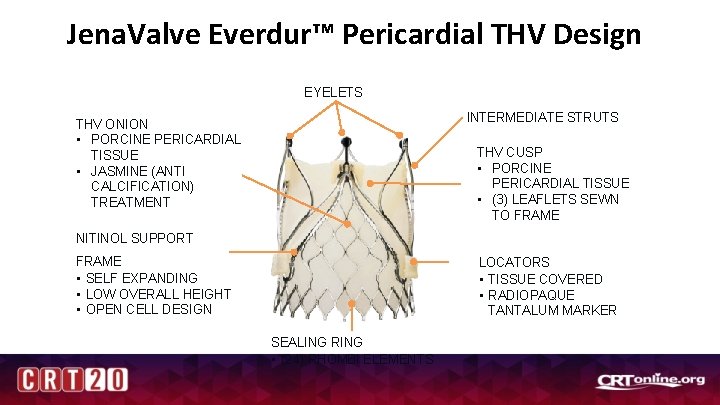 Jena. Valve Everdur™ Pericardial THV Design EYELETS INTERMEDIATE STRUTS THV ONION • PORCINE PERICARDIAL