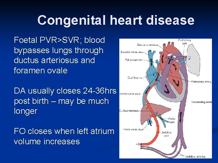 Congenital heart disease Foetal PVR>SVR; blood bypasses lungs through ductus arteriosus and foramen ovale