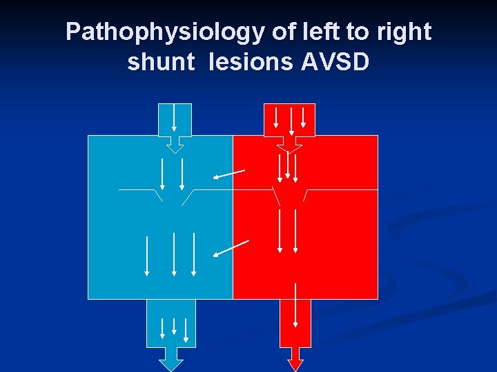 Pathophysiology of left to right shunt lesions AVSD 