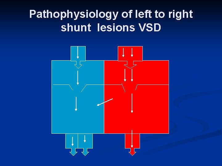 Pathophysiology of left to right shunt lesions VSD 