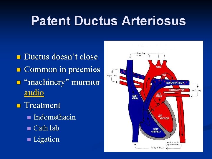 Patent Ductus Arteriosus n n Ductus doesn’t close Common in preemies “machinery” murmur audio