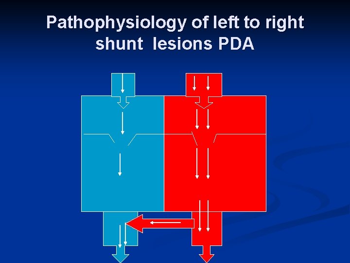 Pathophysiology of left to right shunt lesions PDA 