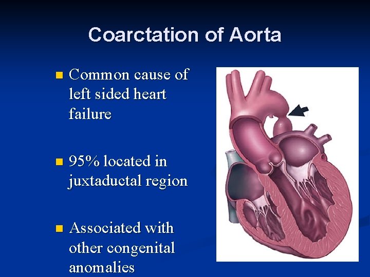 Coarctation of Aorta n Common cause of left sided heart failure n 95% located