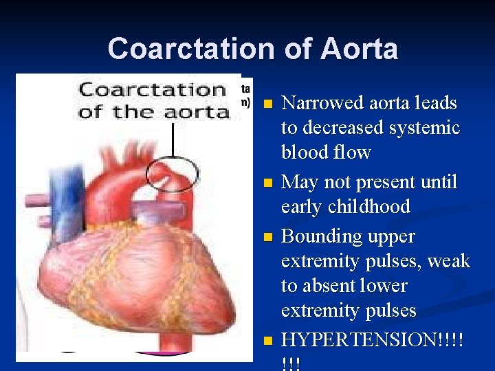 Coarctation of Aorta n n Narrowed aorta leads to decreased systemic blood flow May