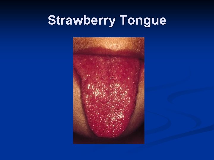 Strawberry Tongue Strawberry Tongue