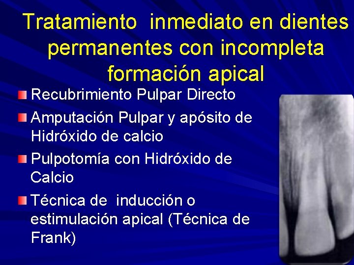 Tratamiento inmediato en dientes permanentes con incompleta formación apical Recubrimiento Pulpar Directo Amputación Pulpar