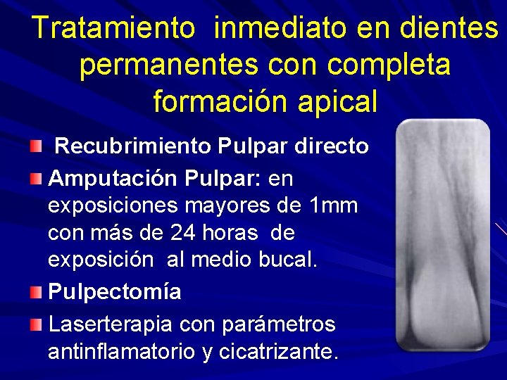 Tratamiento inmediato en dientes permanentes con completa formación apical Recubrimiento Pulpar directo Amputación Pulpar: