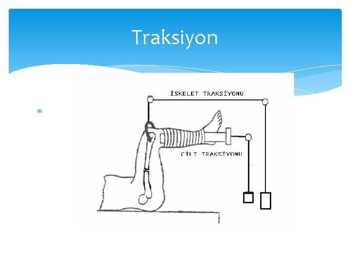 Traksiyon 