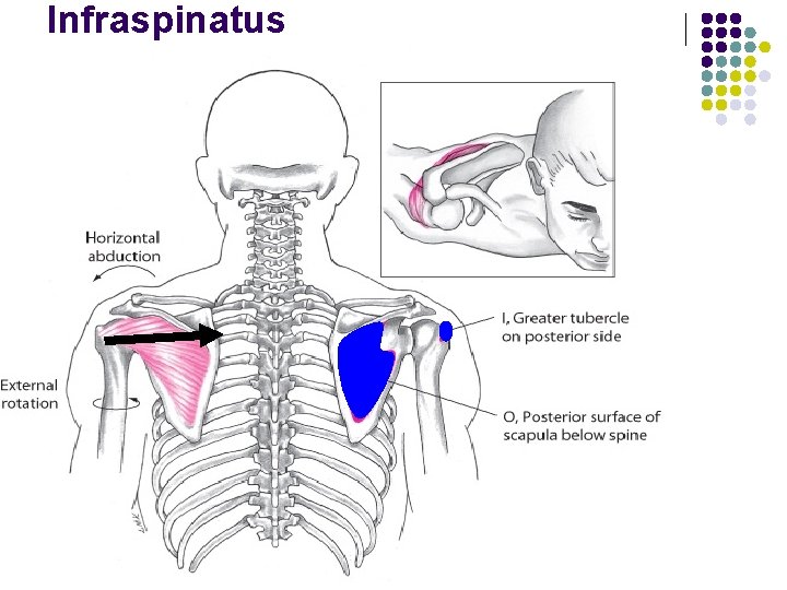 Infraspinatus 