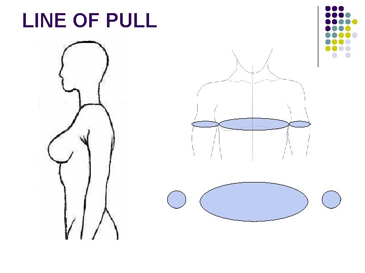 LINE OF PULL 