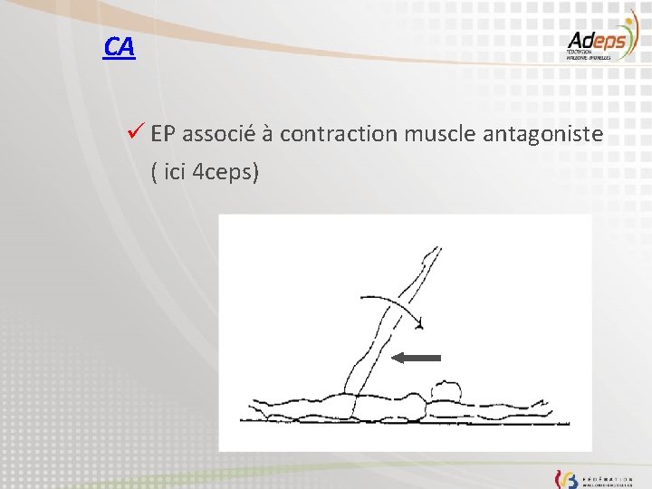 CA ü EP associé à contraction muscle antagoniste ( ici 4 ceps) 