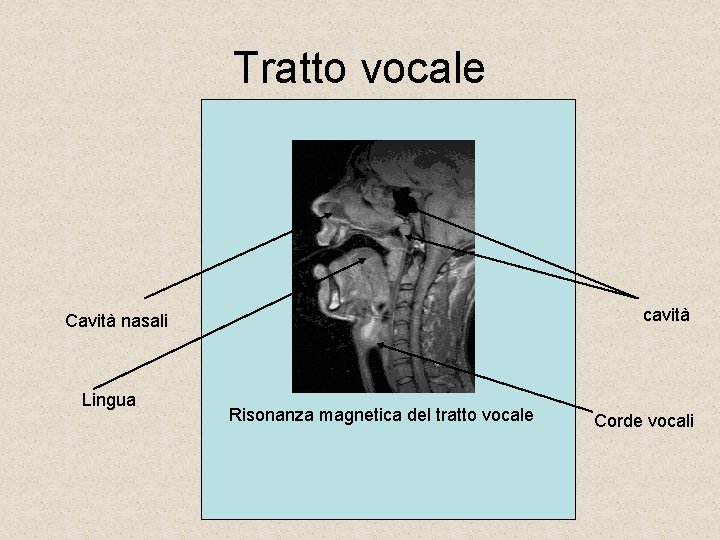 Tratto vocale cavità Cavità nasali Lingua Risonanza magnetica del tratto vocale Corde vocali 