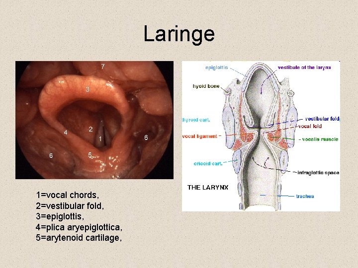 Laringe 1=vocal chords, 2=vestibular fold, 3=epiglottis, 4=plica aryepiglottica, 5=arytenoid cartilage, 